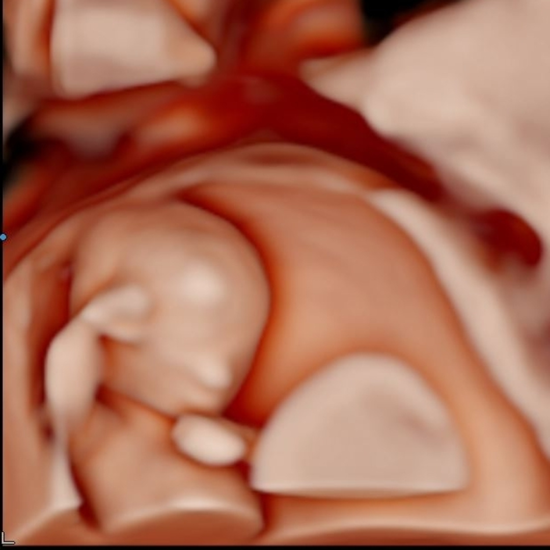 Photo shared by Jose for their Babylist baby registry.