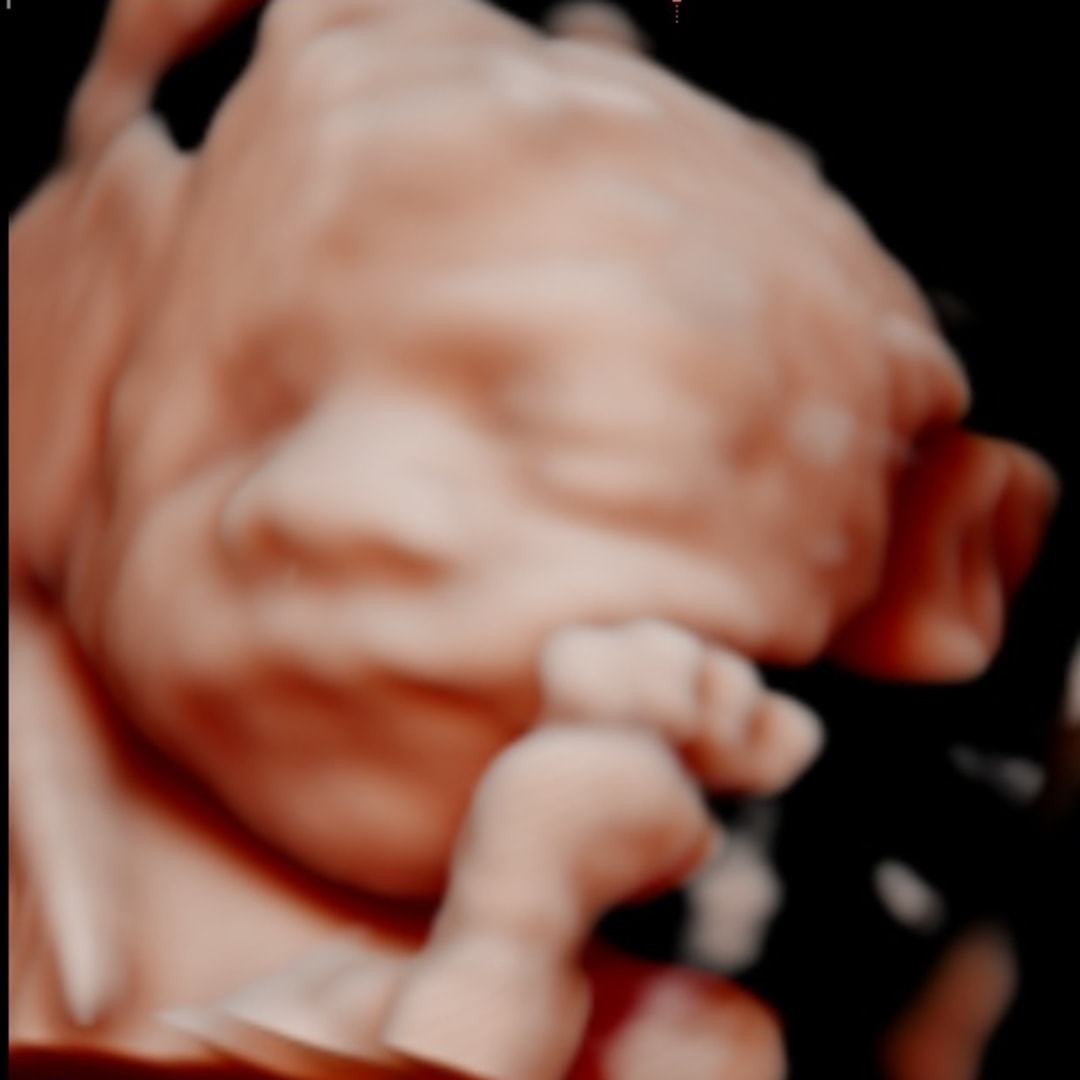 Photo shared by Jacqueline for their Babylist baby registry.