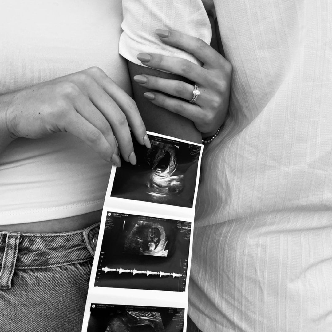 Photo shared by Mckenzie for their Babylist baby registry.