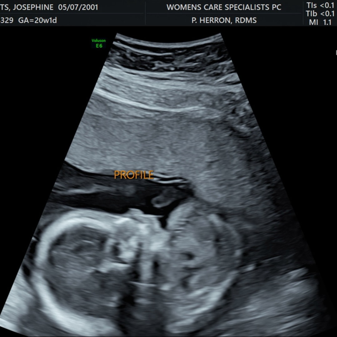 Photo shared by Josie for their Babylist baby registry.