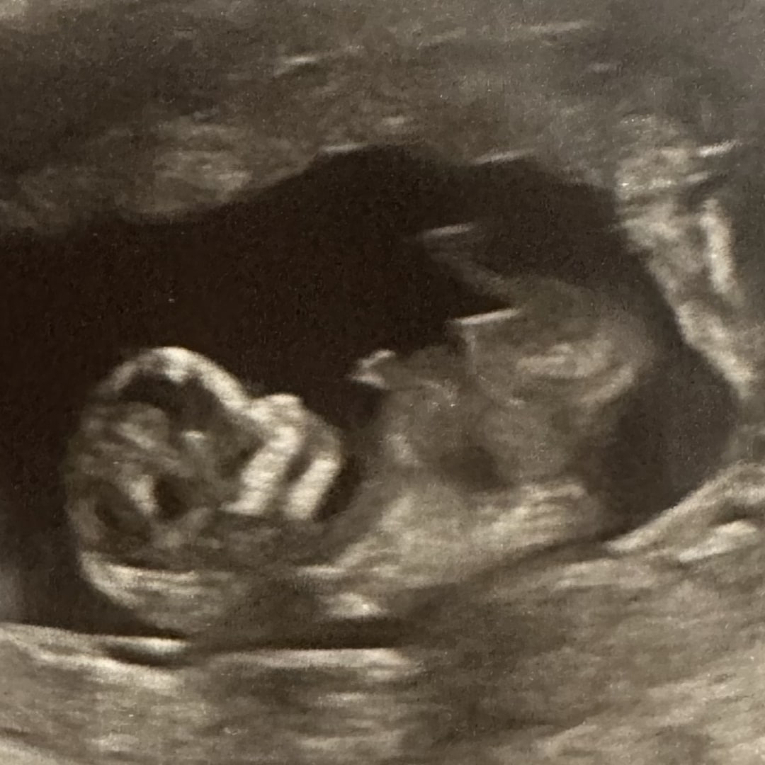 Photo shared by Melissa for their Babylist baby registry.