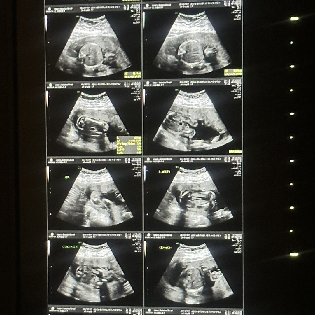 Photo shared by Johelen for their Babylist baby registry.