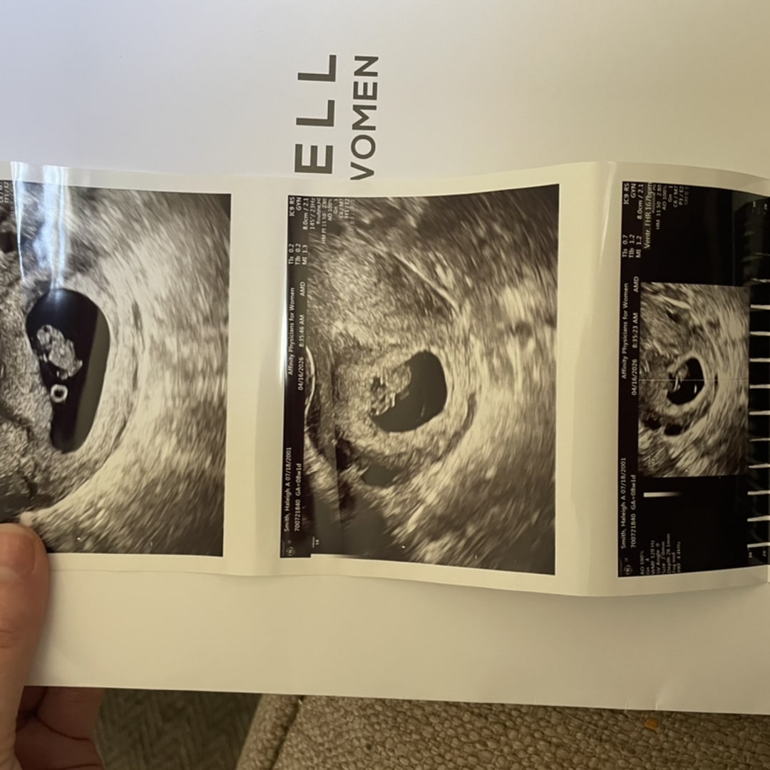 Photo shared by Haleigh for their Babylist baby registry.