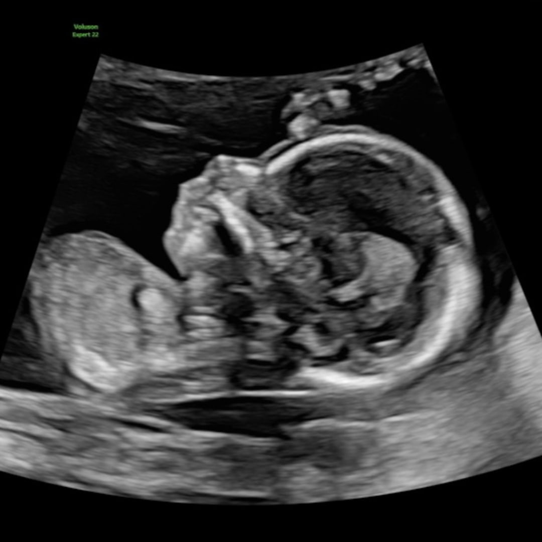 Photo shared by Grace for their Babylist baby registry.