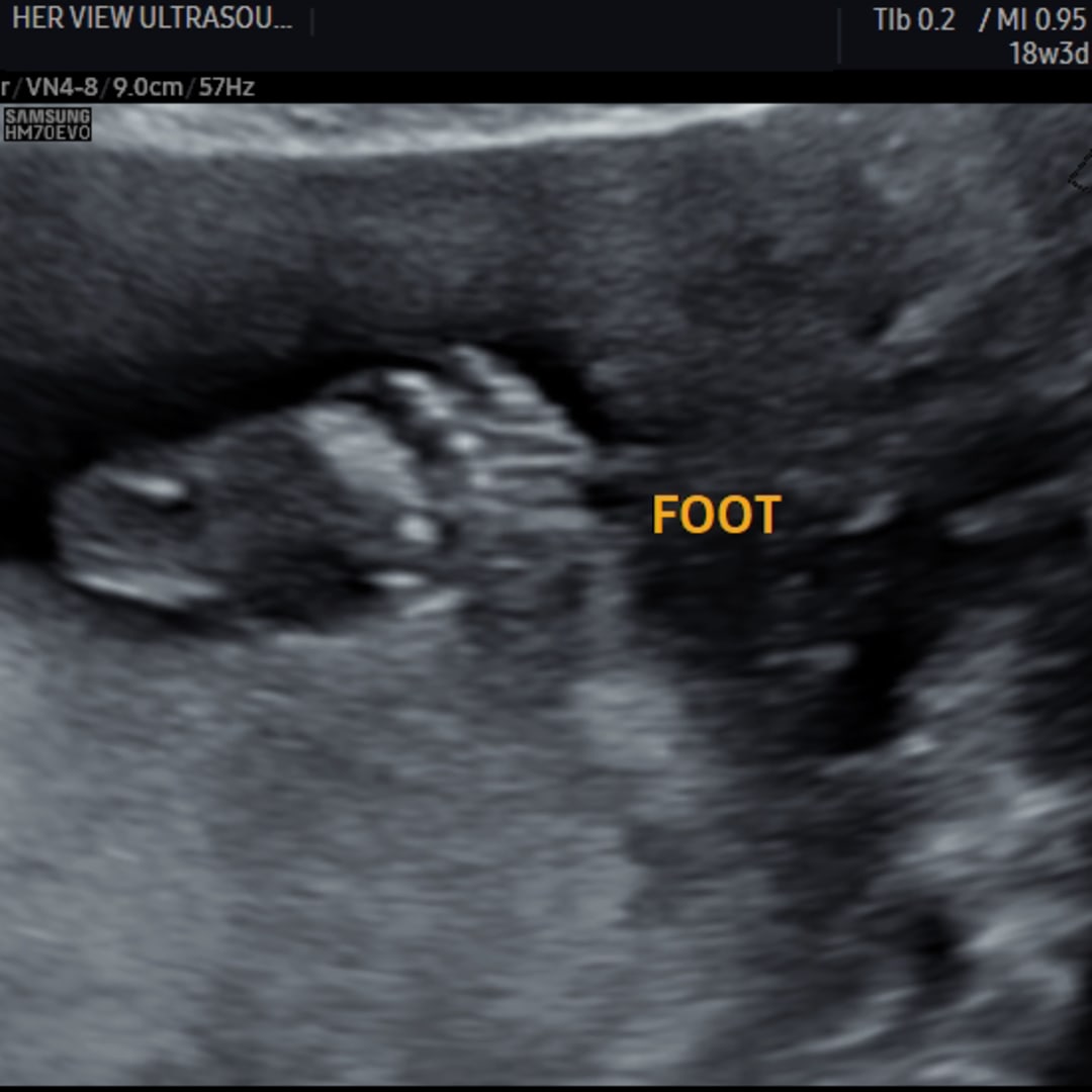 Photo shared by Melissa for their Babylist baby registry.