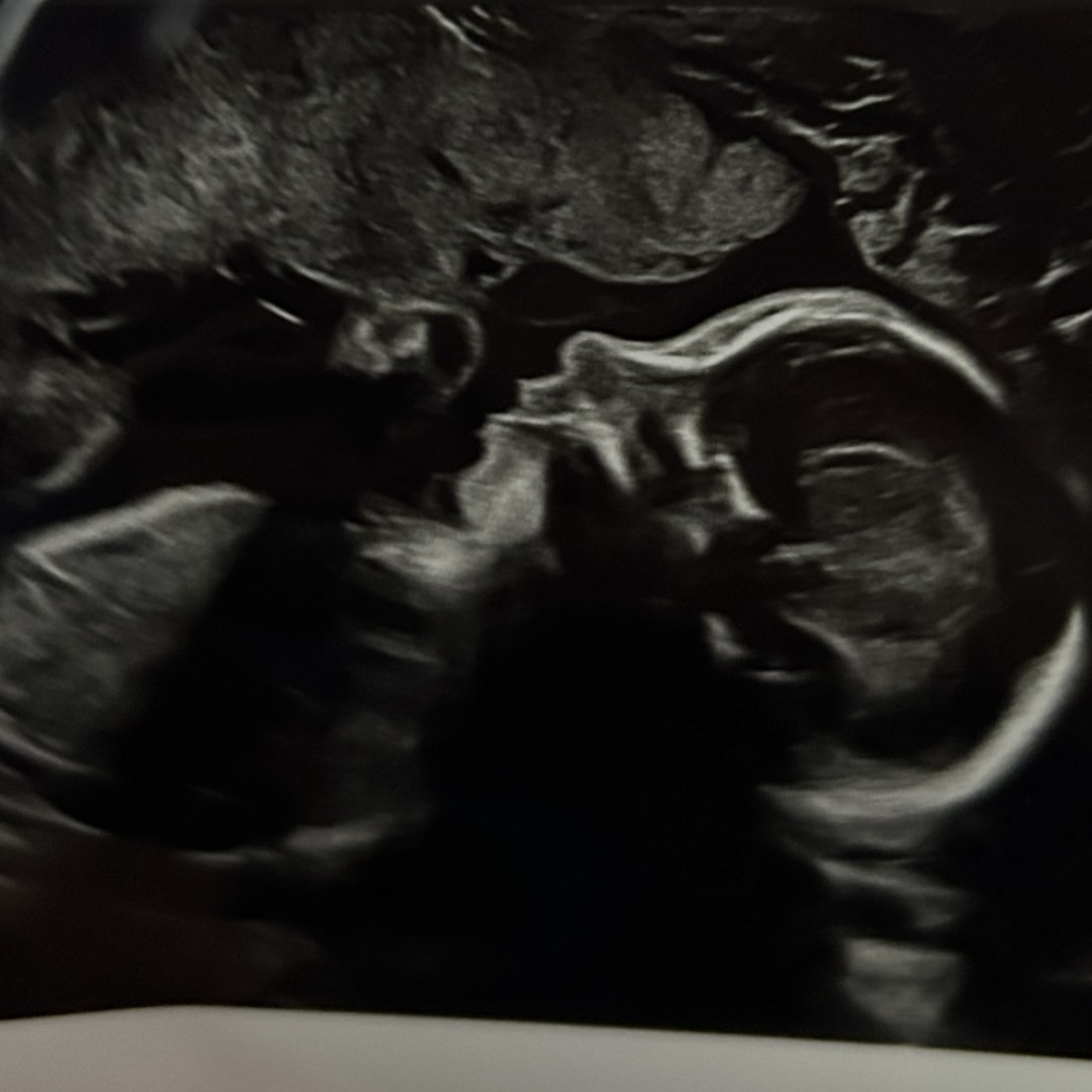 Photo shared by Angela for their Babylist baby registry.