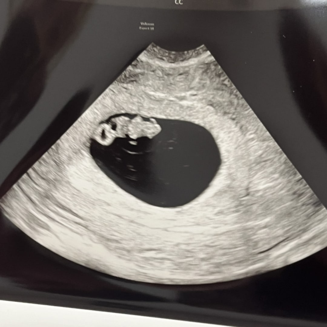 Photo shared by Ella for their Babylist baby registry.