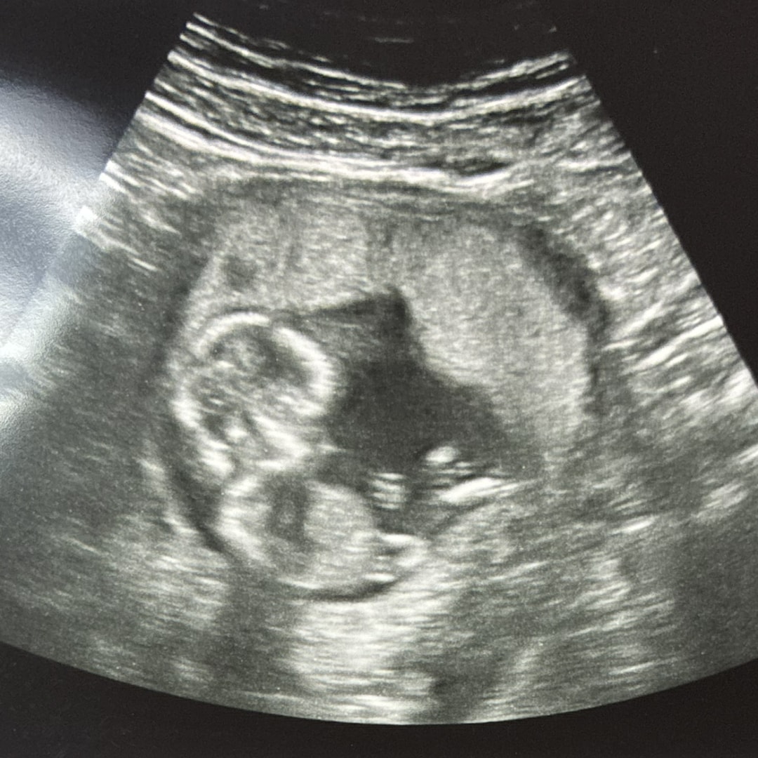 Photo shared by Chelsy for their Babylist baby registry.