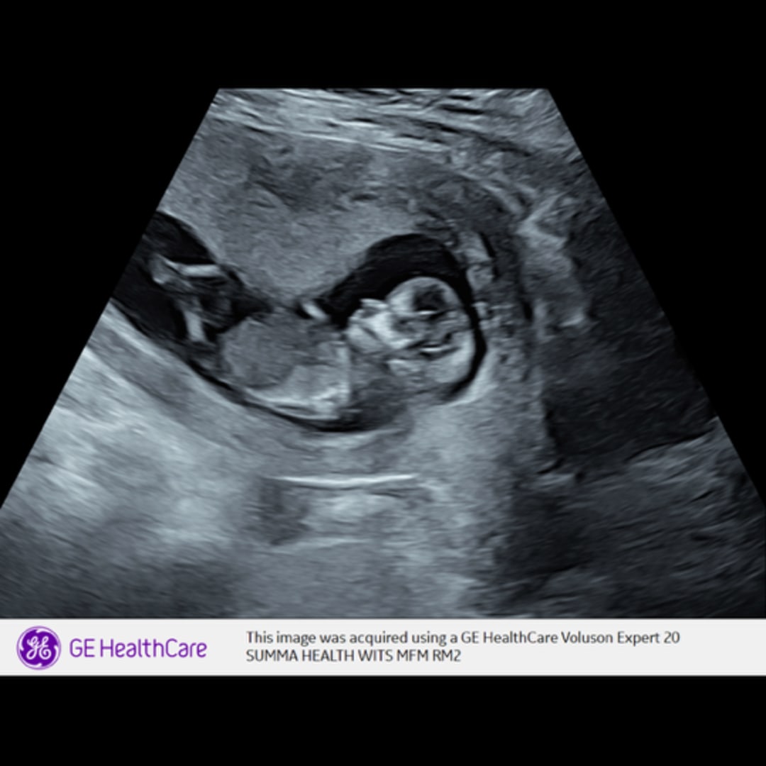 Photo shared by Arian for their Babylist baby registry.