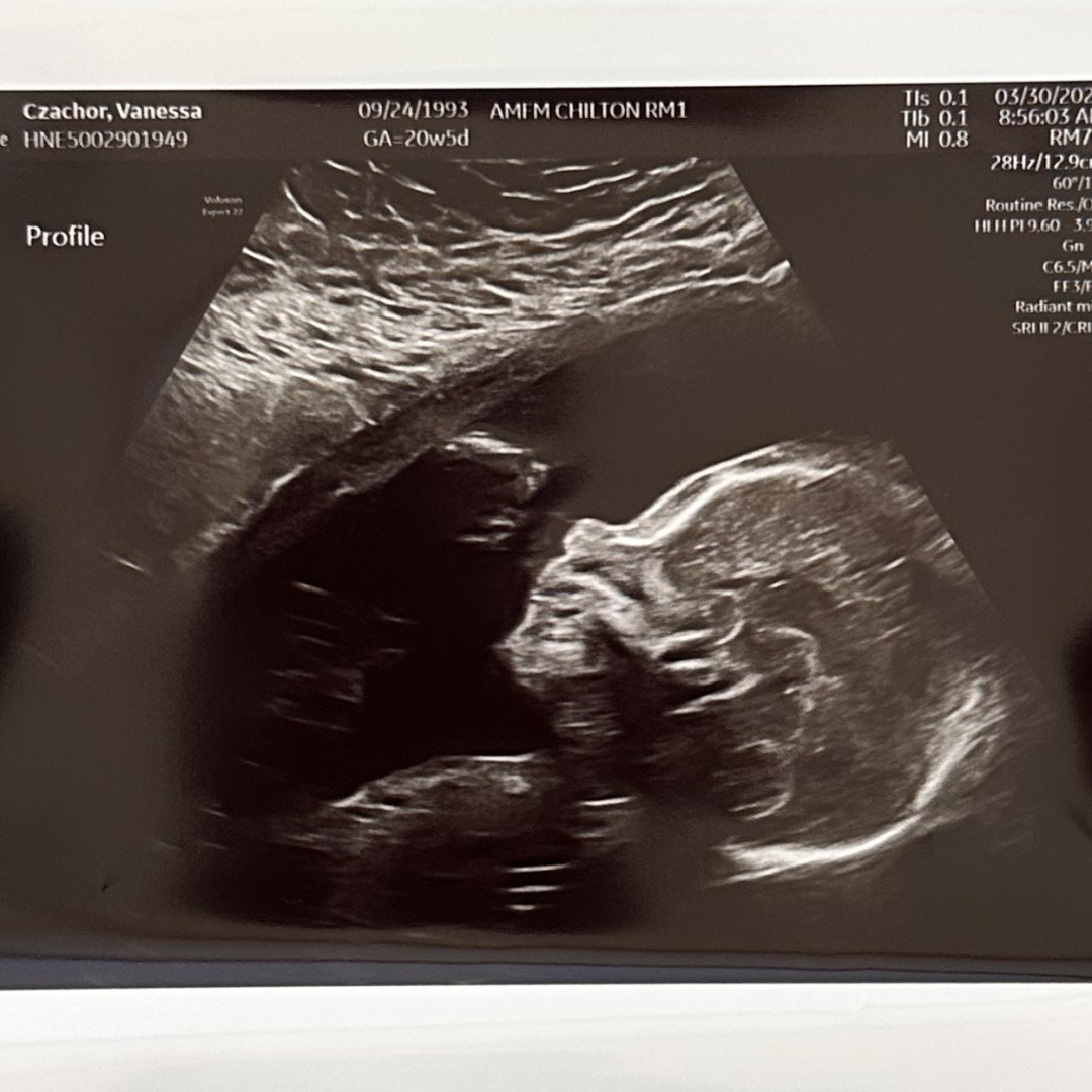 Photo shared by Vanessa for their Babylist baby registry.