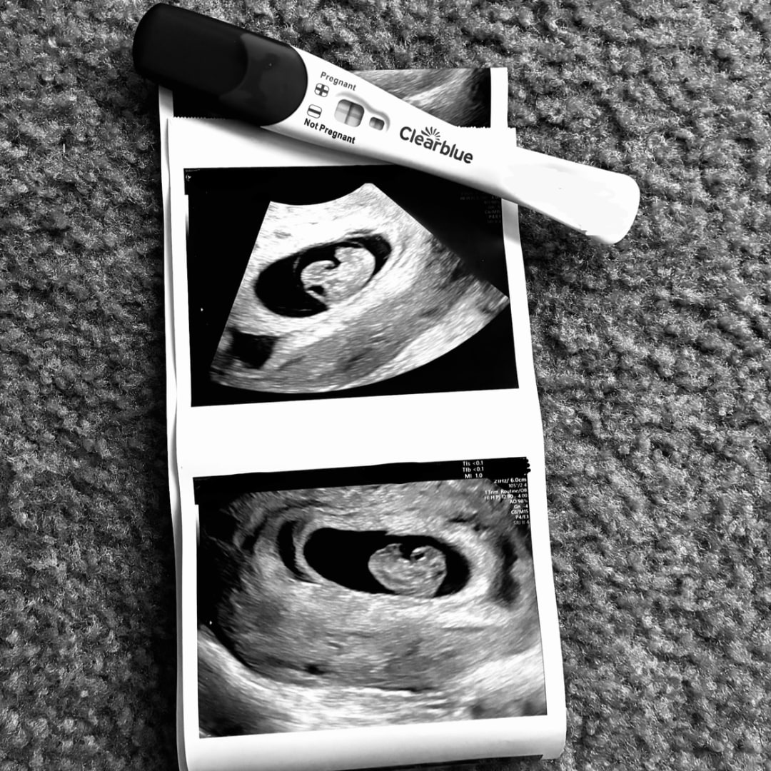 Photo shared by Josie for their Babylist baby registry.