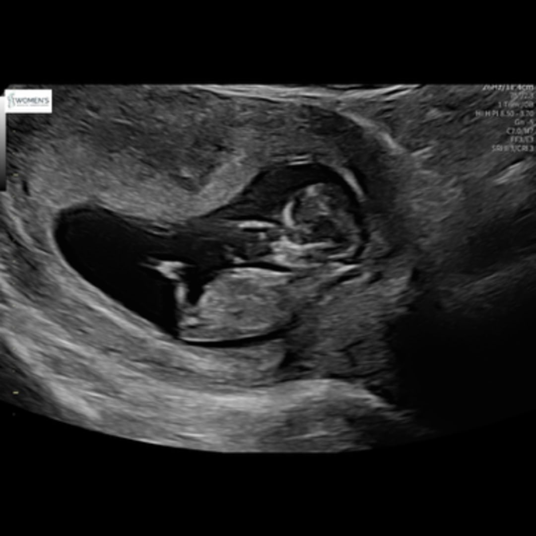 Photo shared by Heather for their Babylist baby registry.