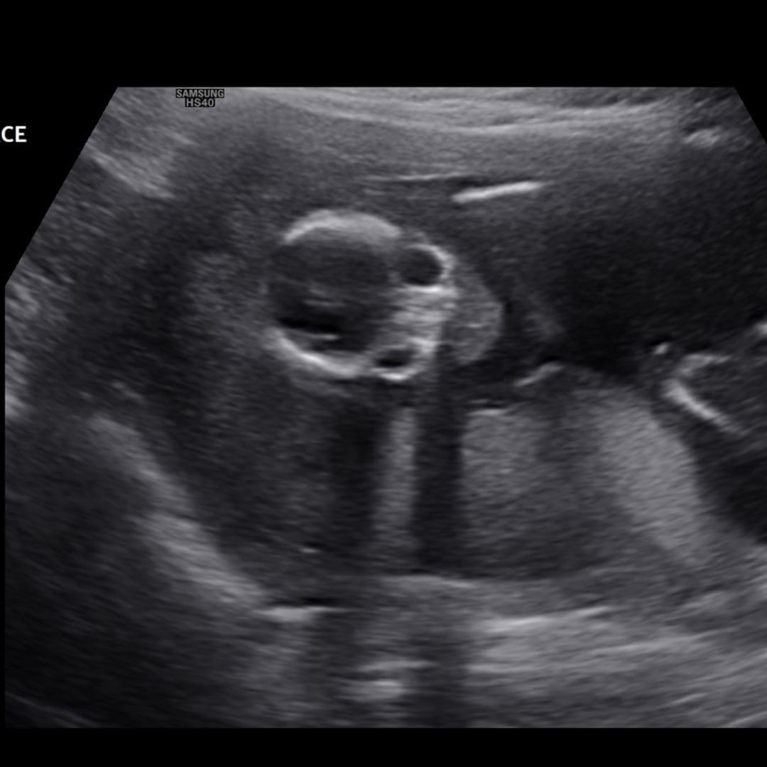 Photo shared by Amber for their Babylist baby registry.