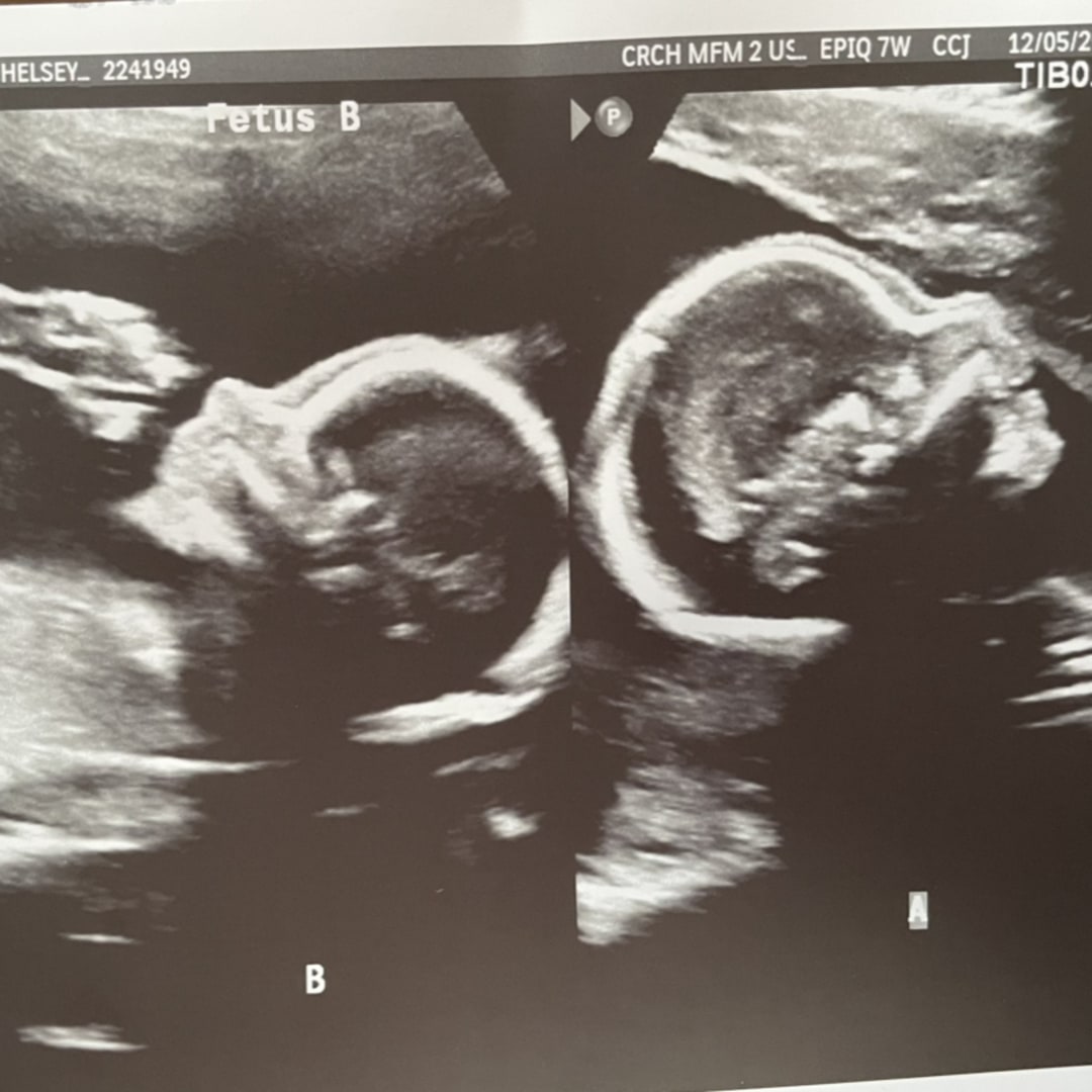 Photo shared by Chelsey for their Babylist baby registry.