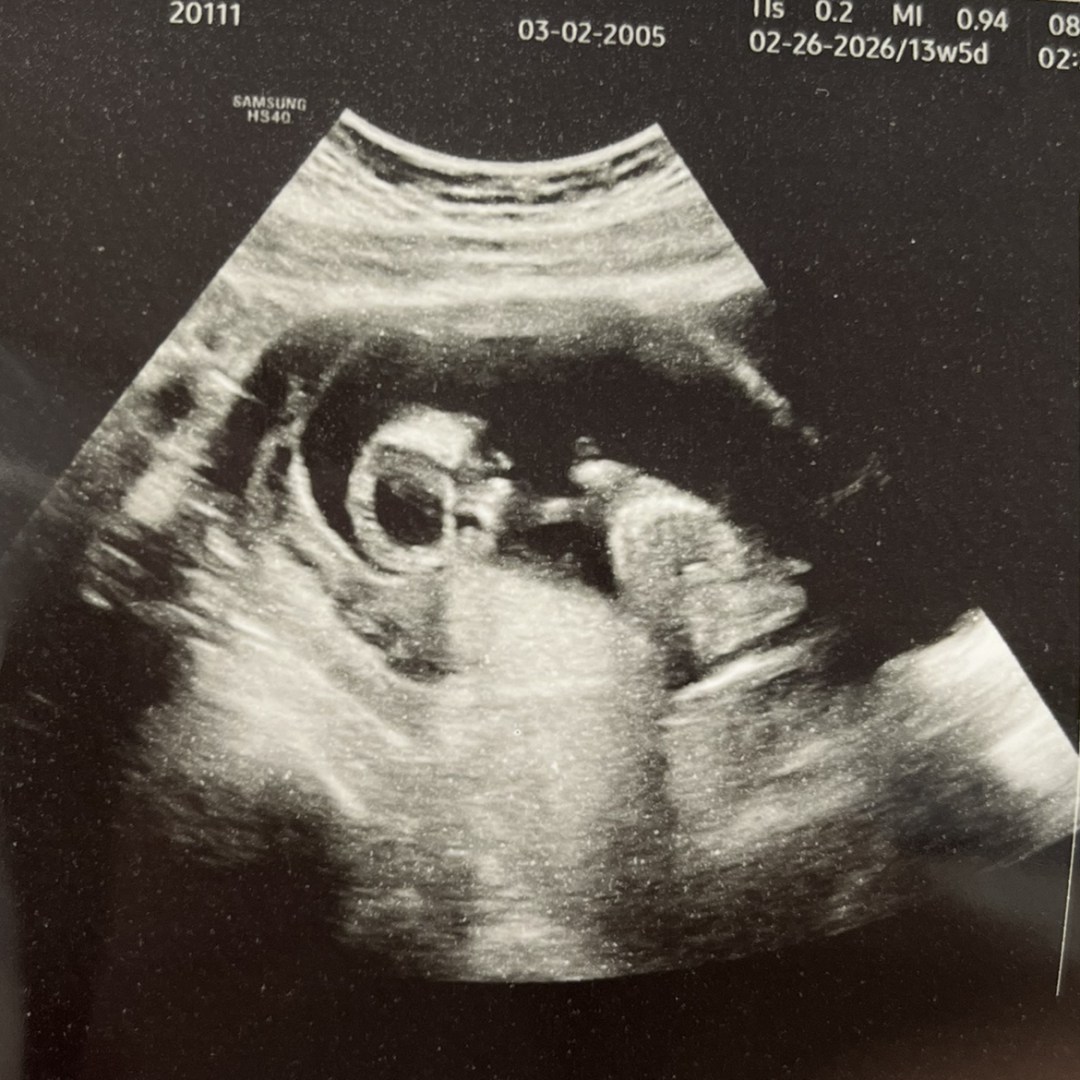 Photo shared by Lea for their Babylist baby registry.