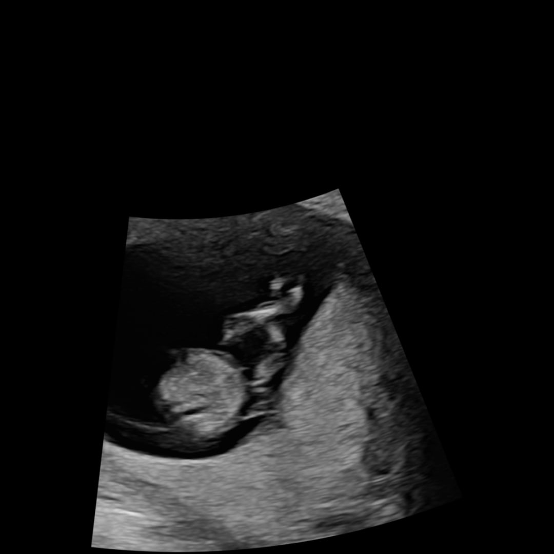 Photo shared by Michelle for their Babylist baby registry.