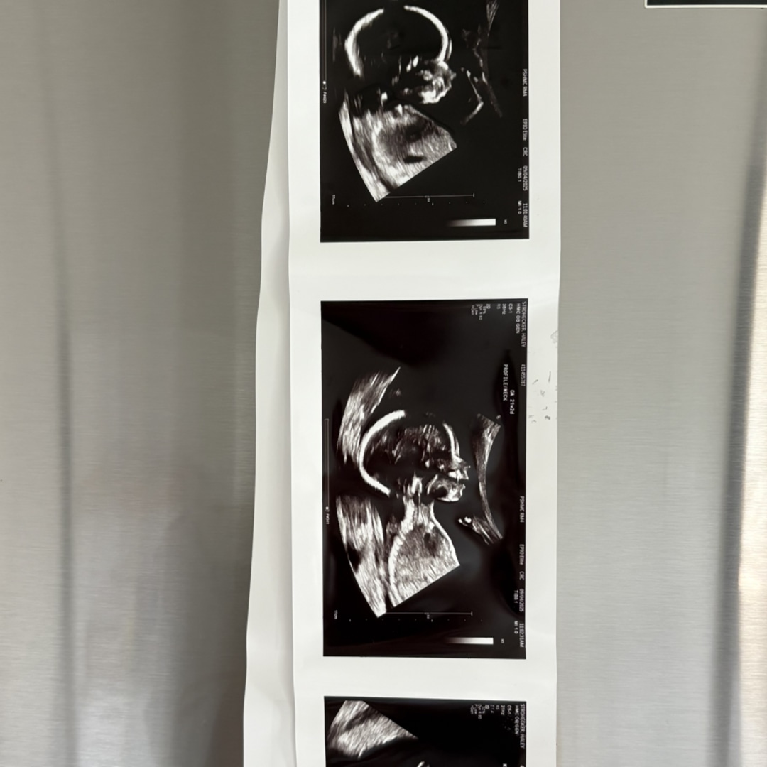 Photo shared by Haley for their Babylist baby registry.