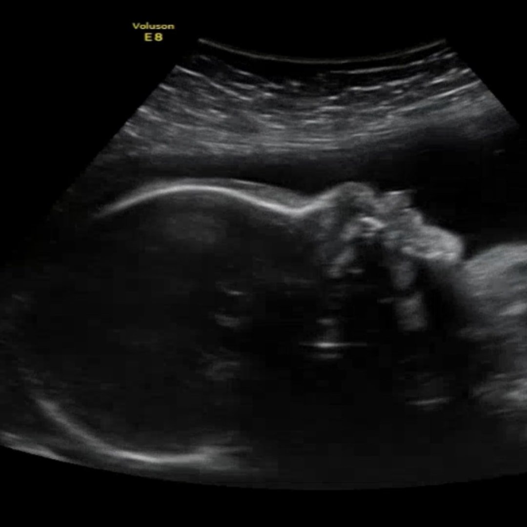 Photo shared by Sydni for their Babylist baby registry.