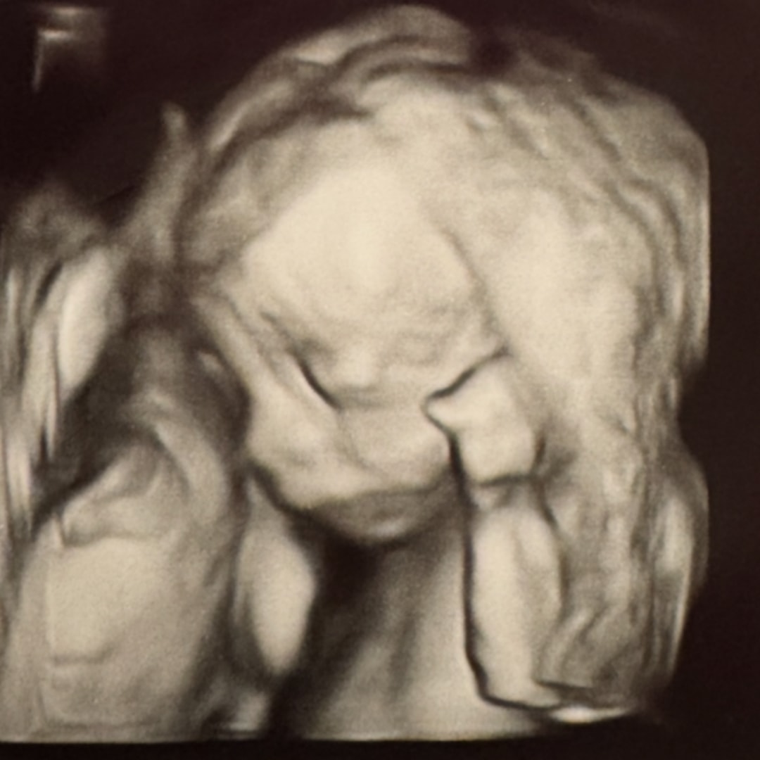 Photo shared by Chelsea for their Babylist baby registry.