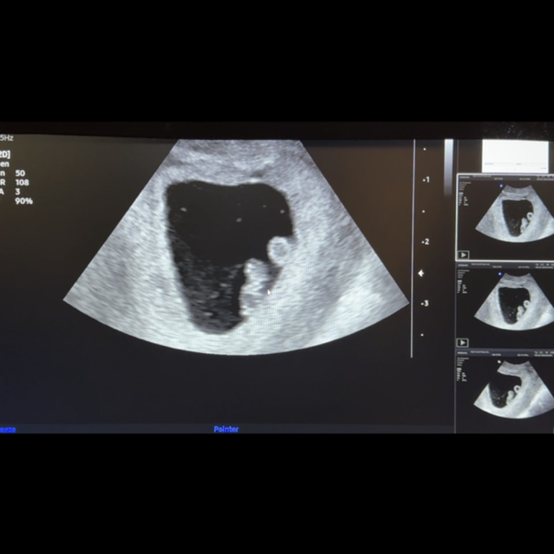 Photo shared by Kailynn for their Babylist baby registry.