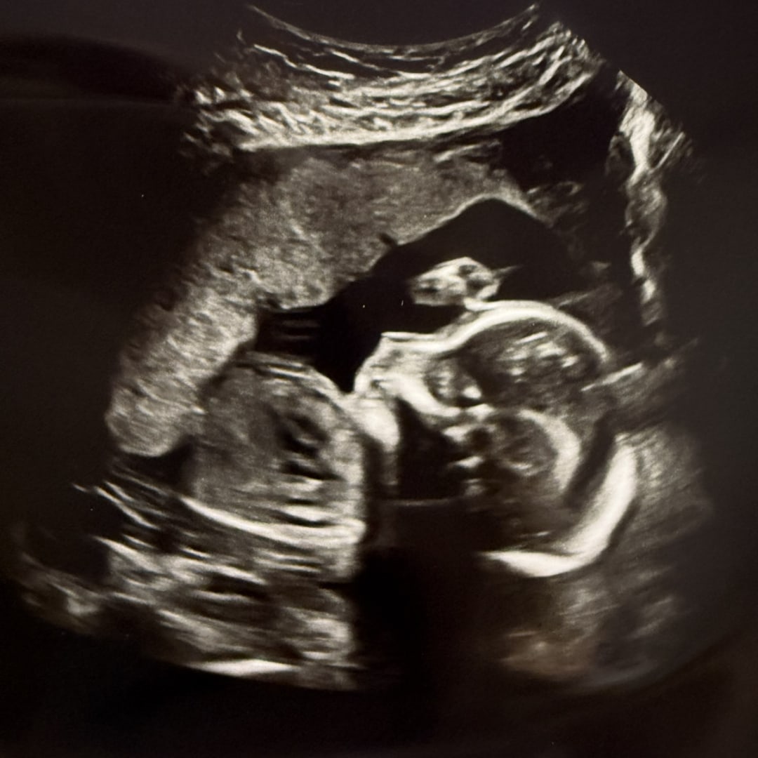 Photo shared by Sarah for their Babylist baby registry.