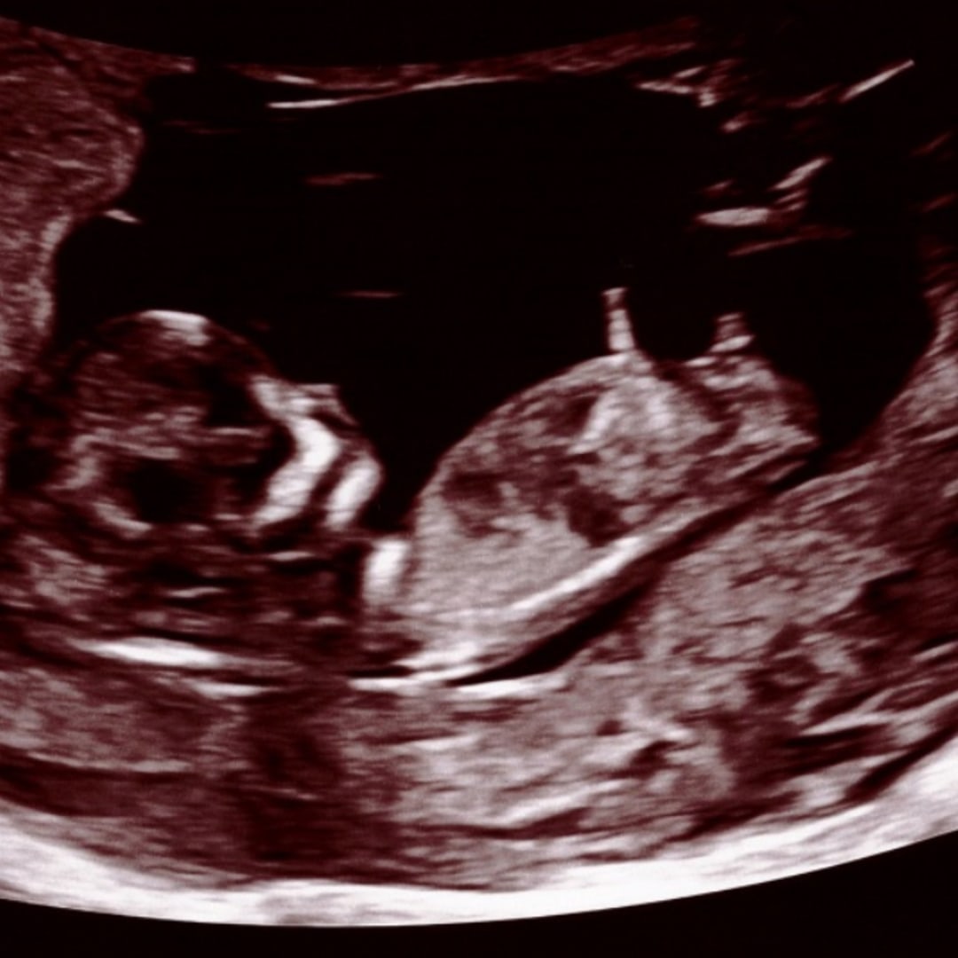 Photo shared by Juliana and Bart for their Babylist baby registry.