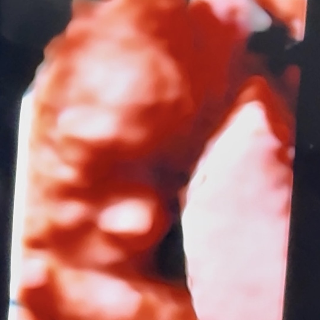 Photo shared by Brooklyn for their Babylist baby registry.