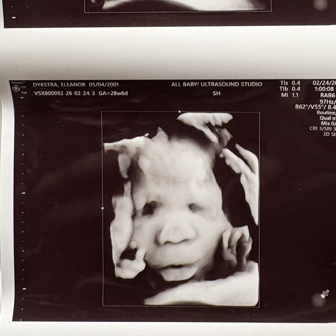 Photo shared by Eleanor for their Babylist baby registry.