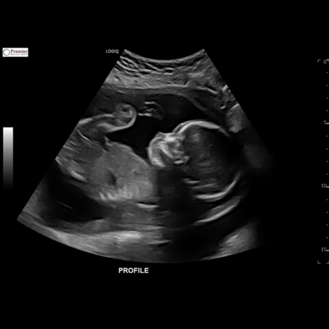 Photo shared by Kailee for their Babylist baby registry.