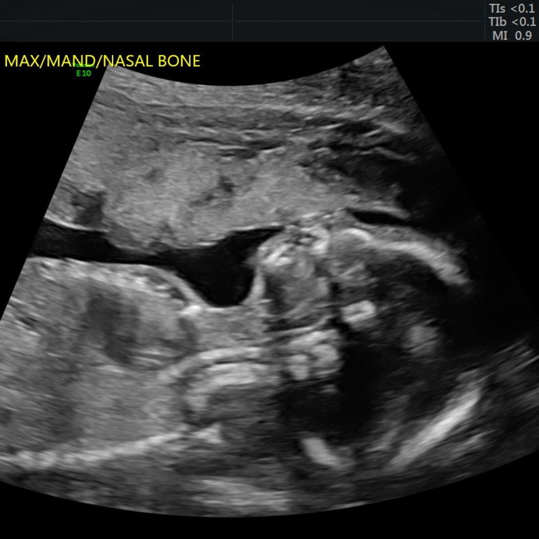 Photo shared by Rachael for their Babylist baby registry.