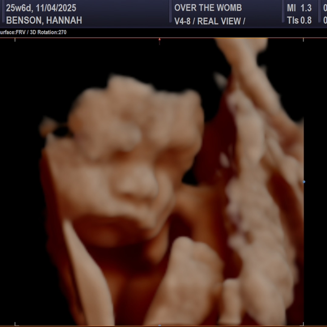 Photo shared by Hannah for their Babylist baby registry.