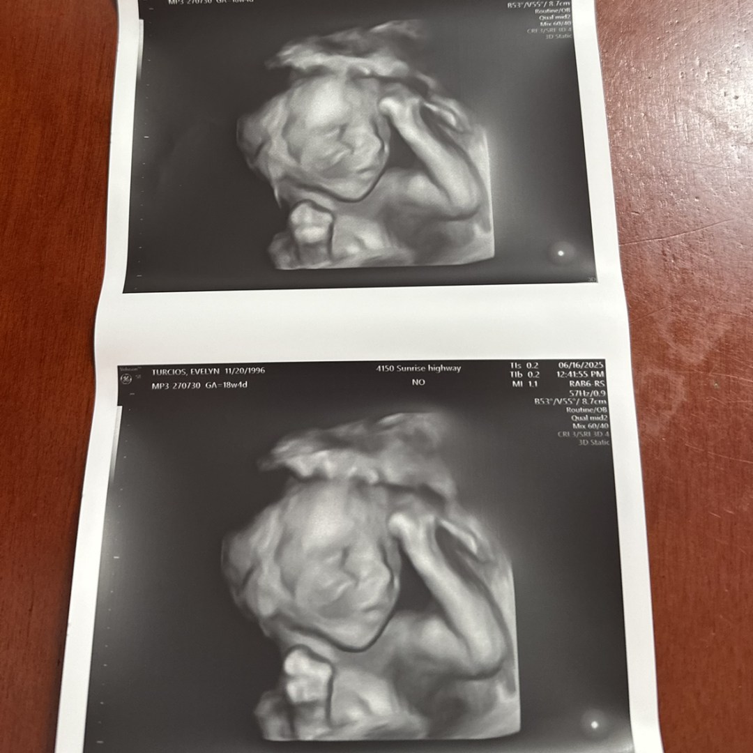 Photo shared by Evelyn for their Babylist baby registry.