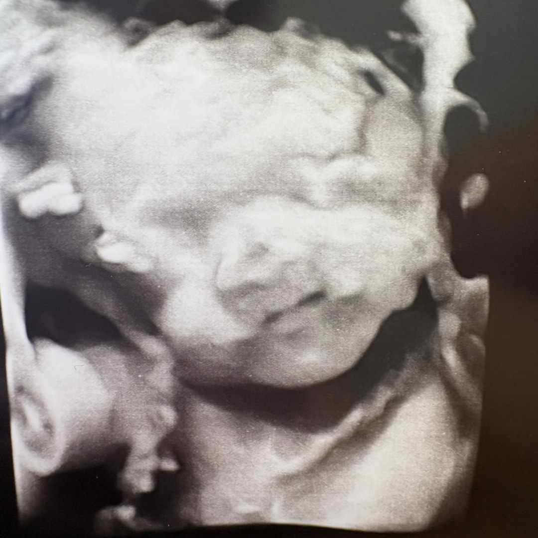 Photo shared by Rebecca for their Babylist baby registry.