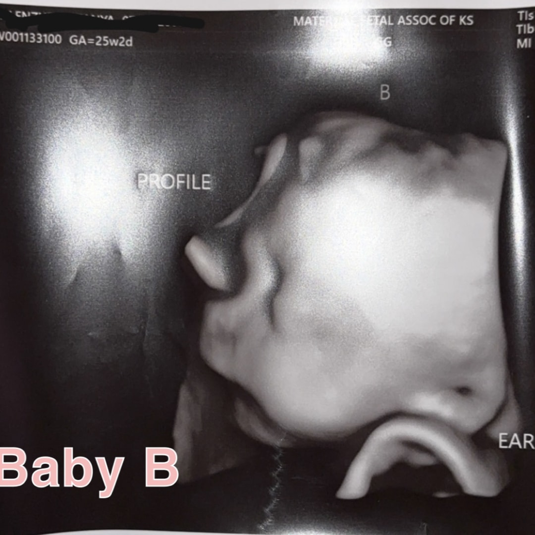 Photo shared by Tanya for their Babylist baby registry.