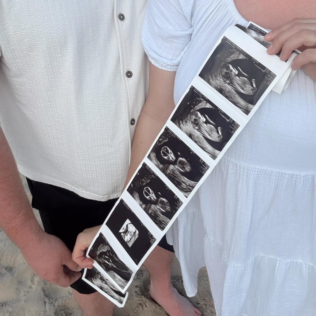 Photo shared by Summer for their Babylist baby registry.