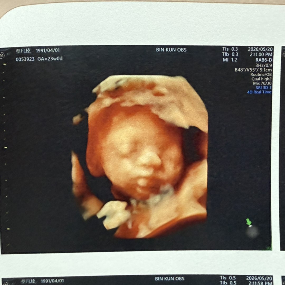 Photo shared by Scott for their Babylist baby registry.
