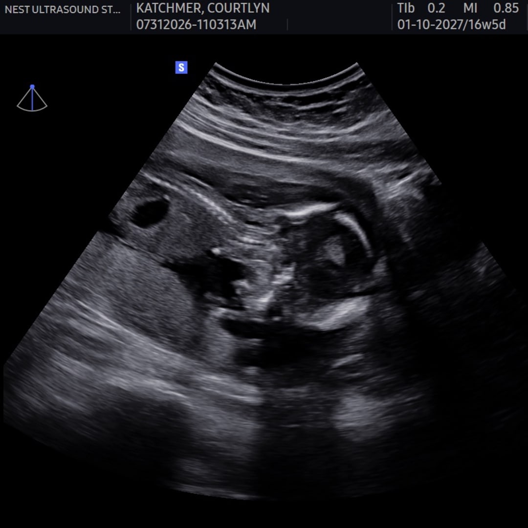 Photo shared by Courtlyn for their Babylist baby registry.