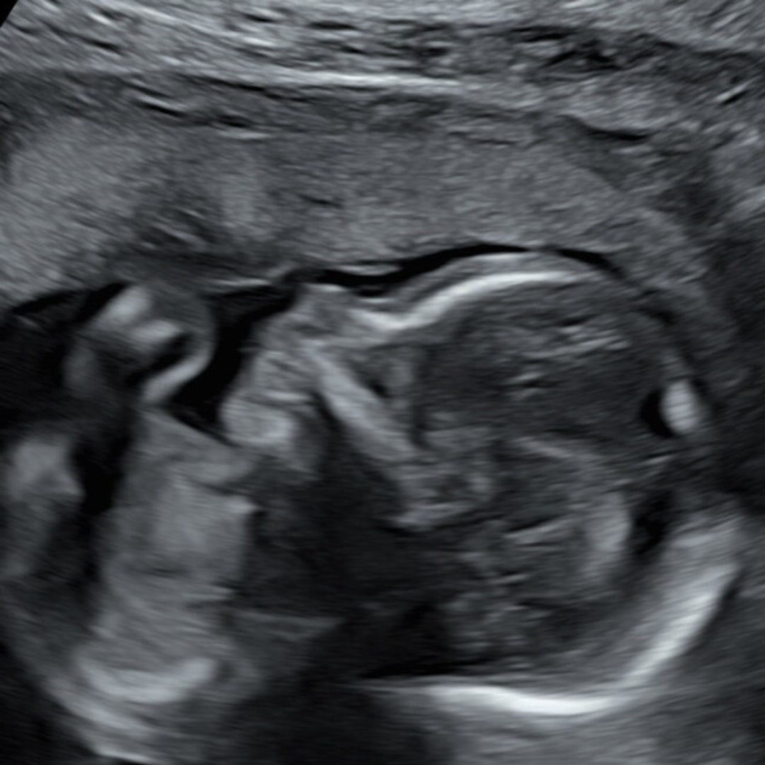 Photo shared by Alma for their Babylist baby registry.
