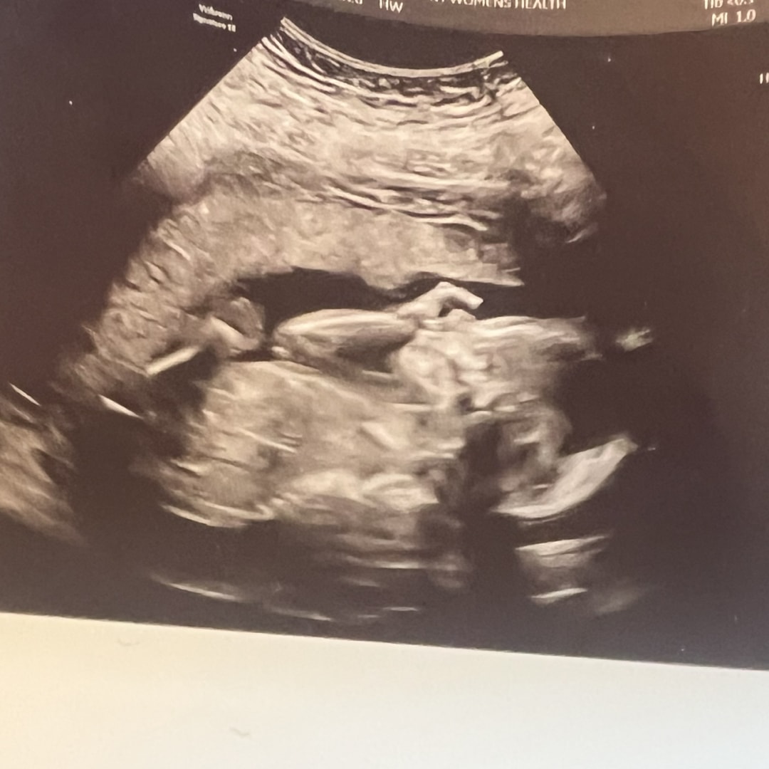 Photo shared by Amanda for their Babylist baby registry.