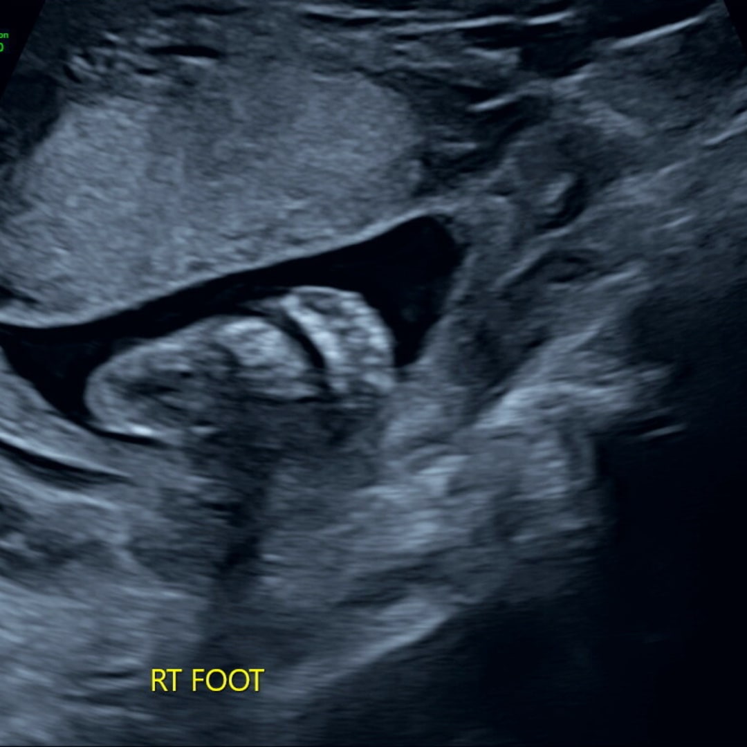 Photo shared by Emma for their Babylist baby registry.