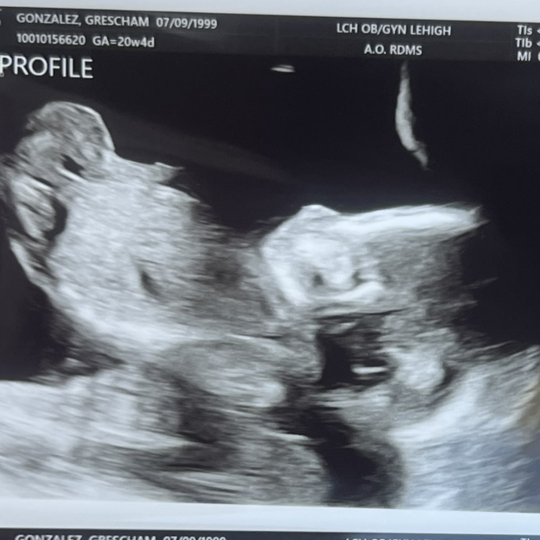 Photo shared by Grescham for their Babylist baby registry.