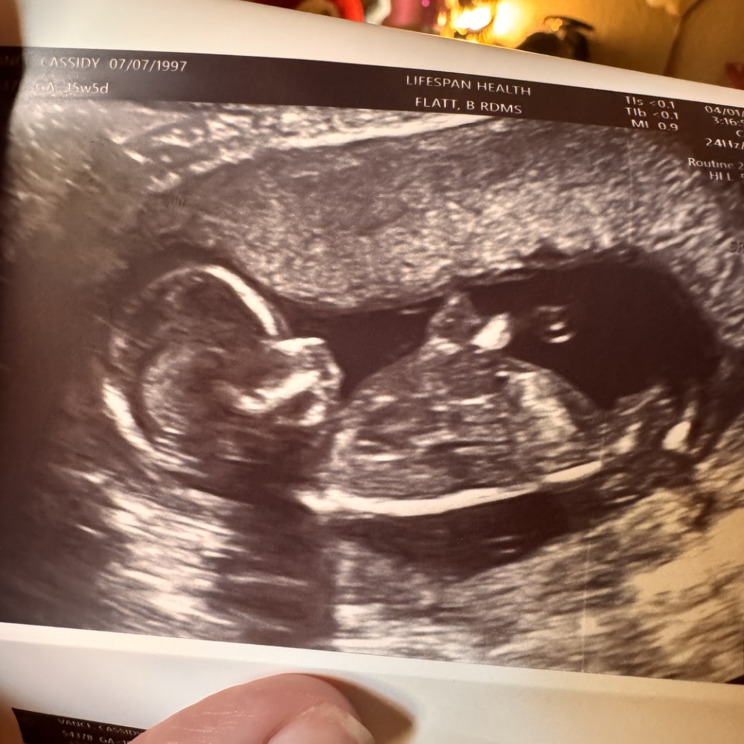 Photo shared by Cassidy for their Babylist baby registry.