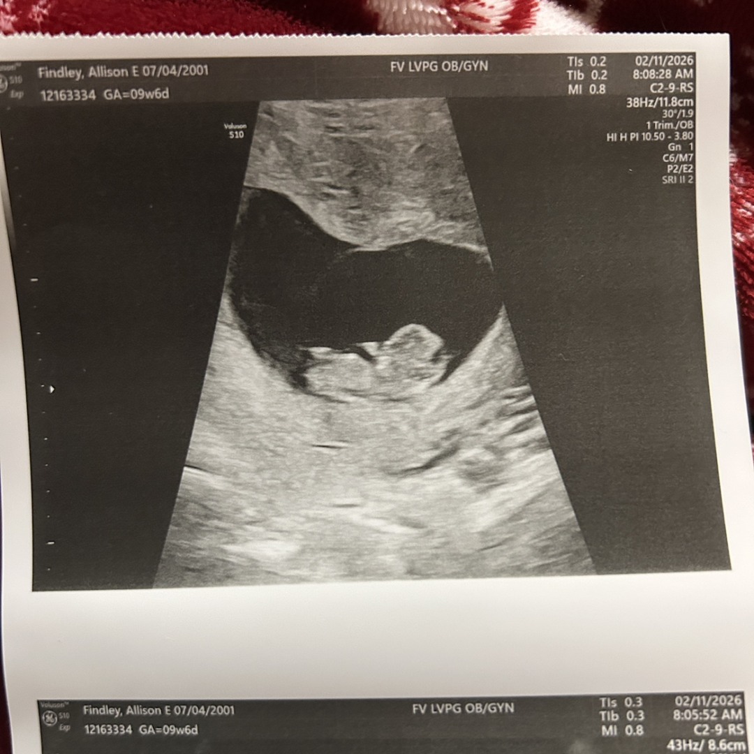 Photo shared by Allison for their Babylist baby registry.