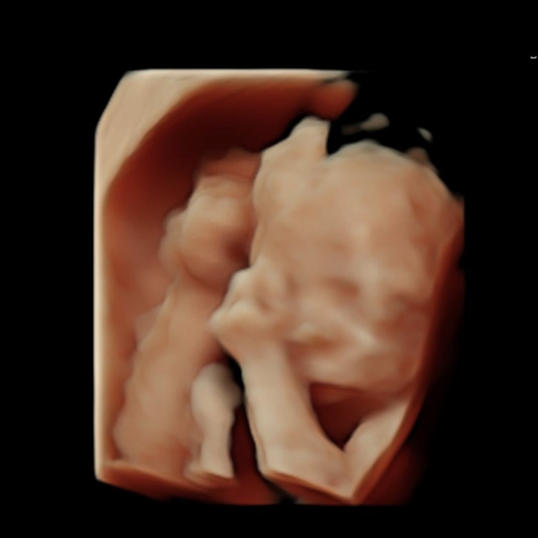 Photo shared by Emily for their Babylist baby registry.