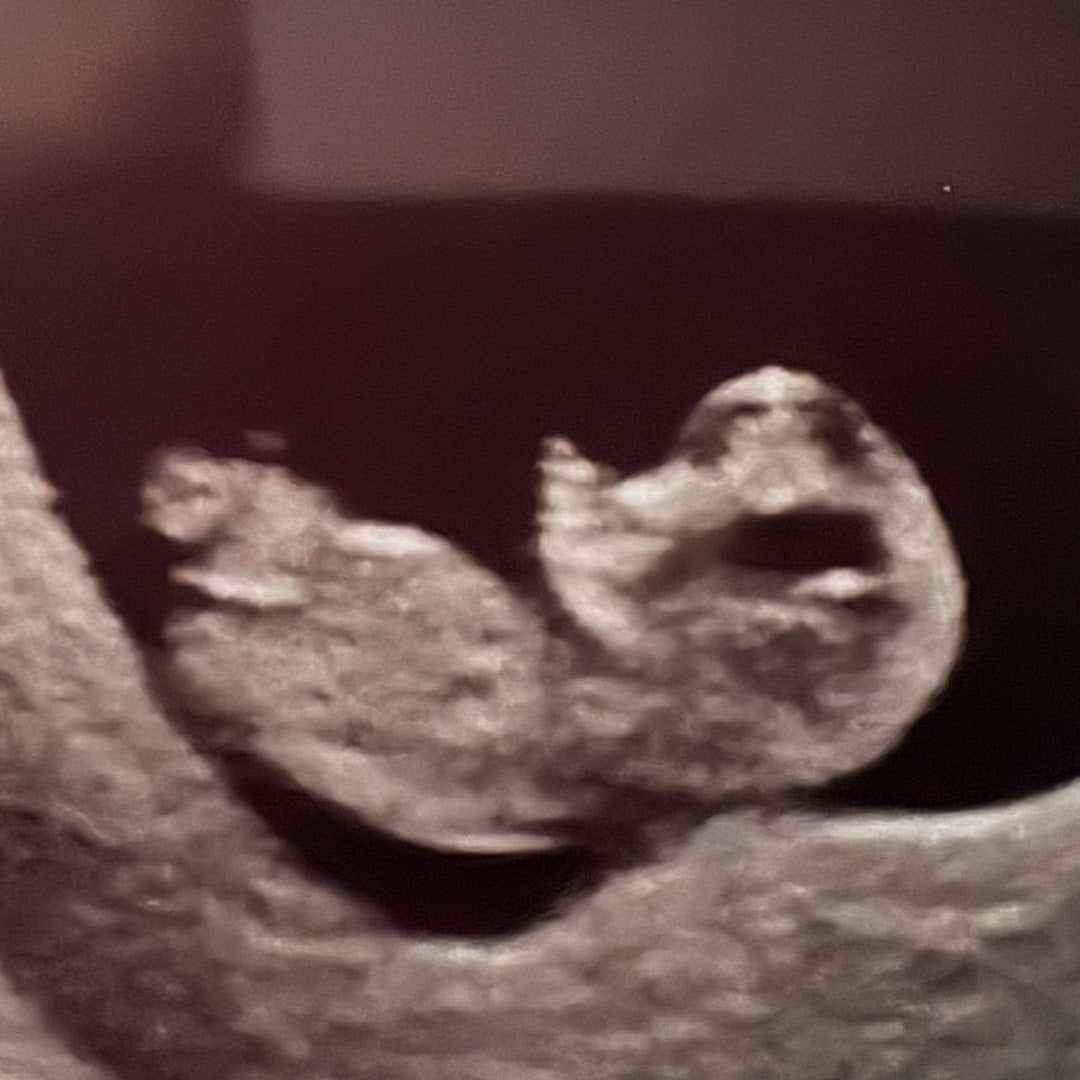 Photo shared by Liz for their Babylist baby registry.
