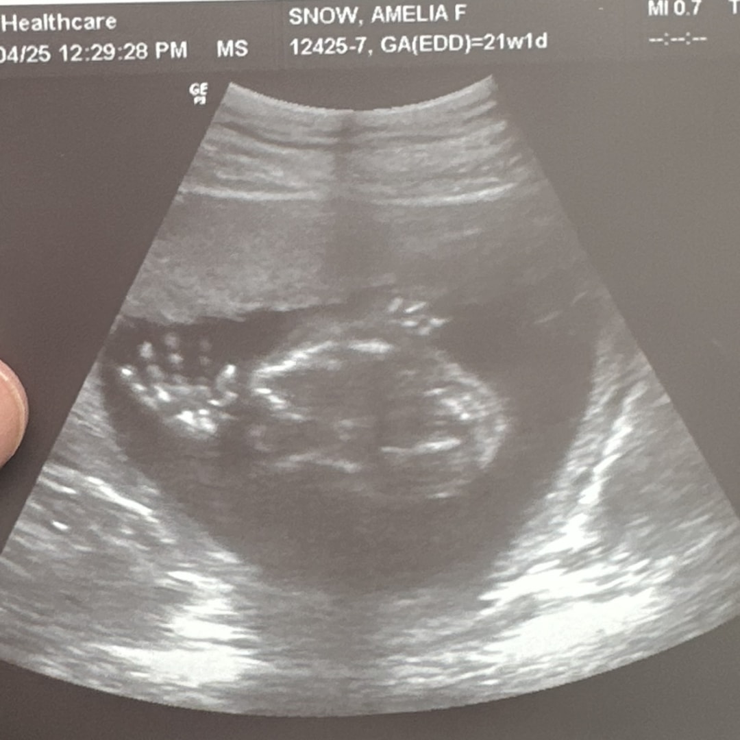 Photo shared by Amelia for their Babylist baby registry.