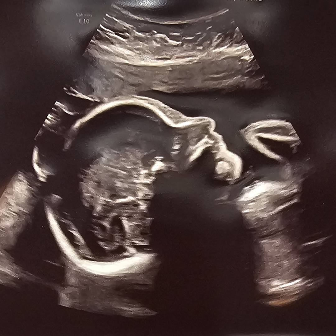 Photo shared by Katie for their Babylist baby registry.