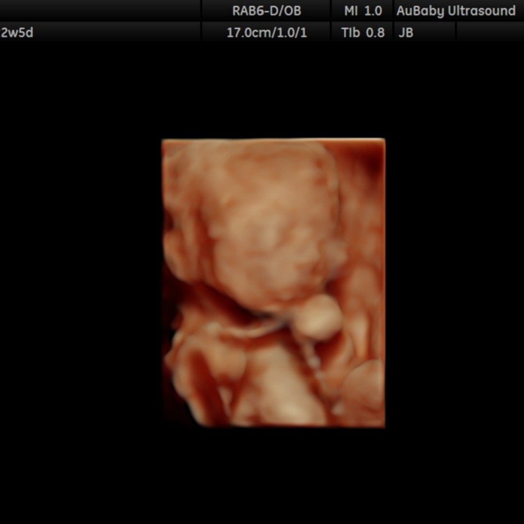 Photo shared by Ashlie for their Babylist baby registry.