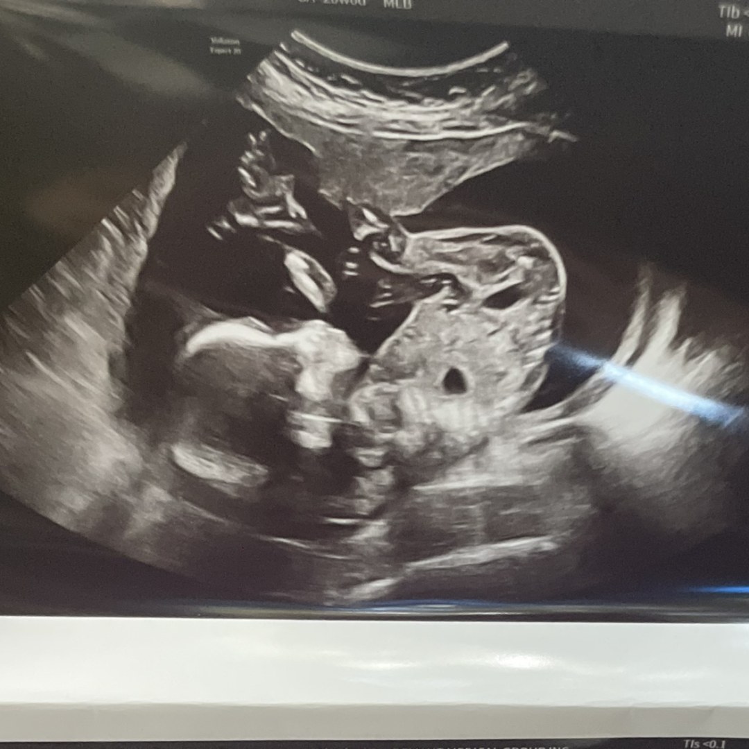 Photo shared by Courtney for their Babylist baby registry.