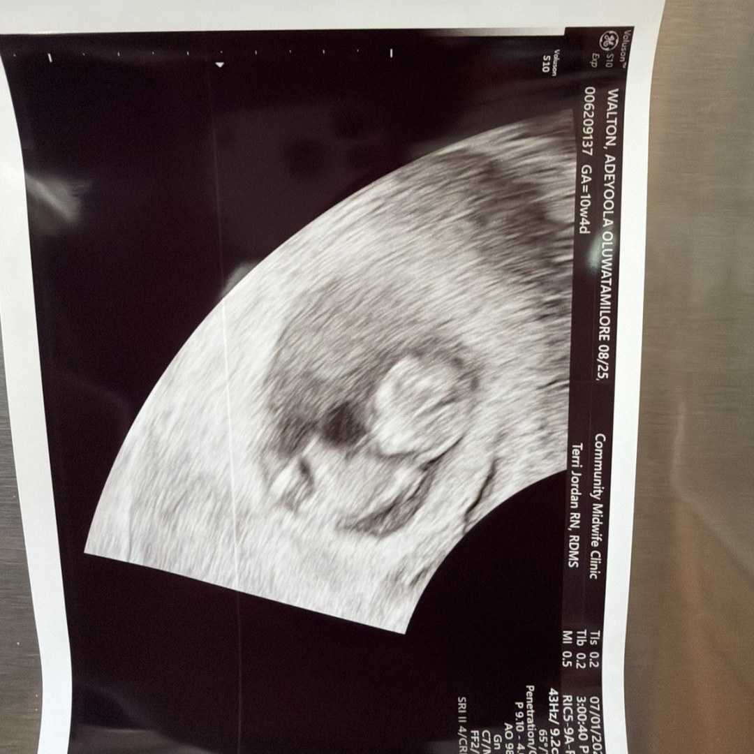Photo shared by Dey for their Babylist baby registry.